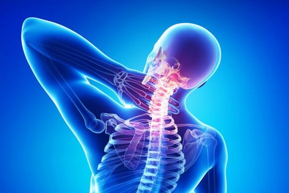 Osteocondrose