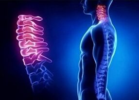 As razóns para o desenvolvemento da osteocondrose do cérvix