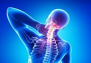 Complicacións probables cunha osteocondrose